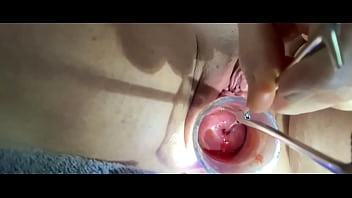 bdsm insertion anal proctoscope
