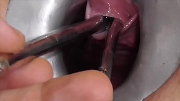 insertion female urethra